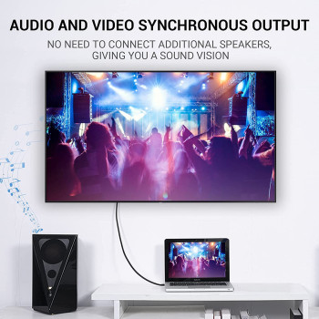 Vention Mini DisplayPort Cable, 4K@60Hz for MacBook Pro, MacBook Pro/Air Ultra HD (Mini DP to DP, 1.5m)