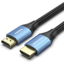 Vention UHD HDMI 2.0 4K Cable 18Gbps 4K@60Hz 3D, Video Return HDCP 2.2 for PS4 Xiaomi Mi Box HDMI Audio Cable Switch Splitter for TV HDMI Splitter Video Cord (1.5 Meter, ALH Series, Blue)