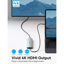 Vention USB C Hub Multiport Adapter Dock, Vention 7 in 1 Type C Dongle to 4K HDMI 3 USB 3.0 Port 100W PD SD/TF Card Readers for Laptop MacBook Air iPad Pro XPS Thunderbolt Hub Multiport Adapter