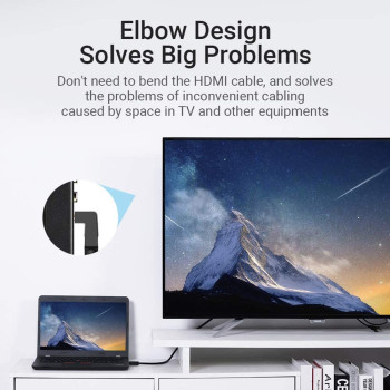 Vention AAQBG HDMI Angle Cable 4K HDMI 2.0 Cable HDMI 270 Degree Angle Adapter for Apple TV PS4 Splitter Video Audio (270 Degree, 1.5 METER 270 DEGREE)
