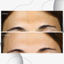 Dermalogica Powerbright Dark Spot Serum 30 ML