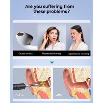 Bebird R1 Wireless Smart Visual Ear Stick With 1080P Otoscope Hd Camera & 6 Led Lights For Ear Cleaning 2 Sprial Silicone Ear Scoops 300W - Black