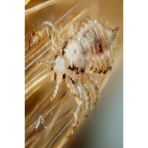 PARANIX Head Lice And Eggs Treatment Spray