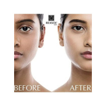 REXSOL Ultra Whitening Alpha-Arbutin Cream 56g