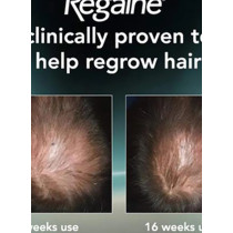 Regaine 3-Piece Scalp Foam Regrowth Foam Set 3 X 73ml