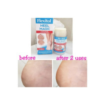Flexitol Heel Magic 70G