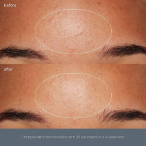 Dermalogica Daily Microfoliant For Skin Care