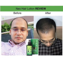 Green Wealth Neo Hair Lotion For Hair Growth 120ml