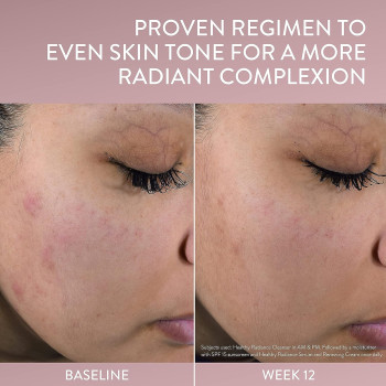 Cetaphil Face Serum, Healthy Radiance Antioxidant-C Serum, 1 Oz