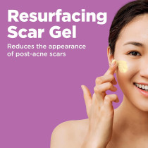 Acne Scar Spot Treatment for Face, Resurfacing Scar Gel, 1 Oz (30 ML)