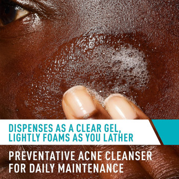 CeraVe Face Wash Acne Treatment Salicylic Acid Cleanser with Purifying Clay for Oily Skin - 8 Fl Oz (Pack of 1)