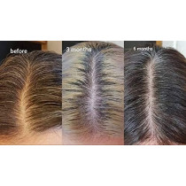 The Ordinary Multi Peptide Serum - Hair Density For All Hair Types, 60 ML (Pack of 1)