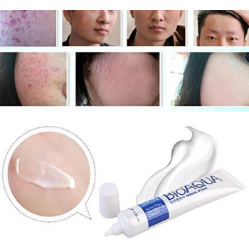 BIOAQUA Acne Anti-Wrinkle Treatment Removal Cream, 30 G