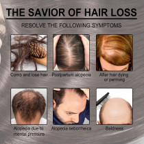 Rosemary Hair Growth Essential Oil For Prevent Hair Loss, Nourish Scalp, Strengthens Hair, 30 ML