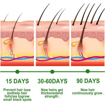 Rosemary Hair Growth Essential Oil For Prevent Hair Loss, Nourish Scalp, Strengthens Hair, 30 ML
