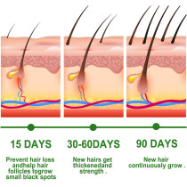Rosemary Hair Growth Essential Oil For Prevent Hair Loss, Nourish Scalp, Strengthens Hair, 30 ML