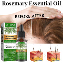 Rosemary Hair Growth Essential Oil For Prevent Hair Loss, Nourish Scalp, Strengthens Hair, 30 ML