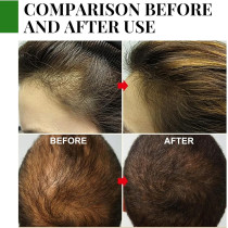 Rosemary Hair Growth Essential Oil For Prevent Hair Loss, Nourish Scalp, Strengthens Hair, 30 ML