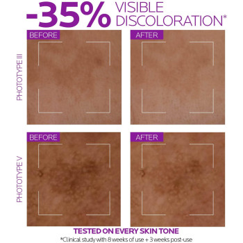 La Roche Posay Pure Niacinamide 10 Anti-Aging Serum For Dark Spots And Pigmentation - 30 ML