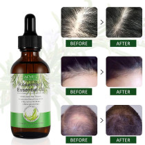 OUHOE Rosemary Hair Essential Oil, Anti Hair Loss Serum, Essential Hair Oil for Damaged Hair, Serum for Hair Repair, Hair Growth and Hair Care - 60ml