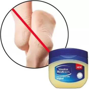 Vaseline Petroleum Jelly...