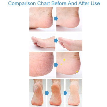 Tarte Shape Tape Concealer Light Medium Honey