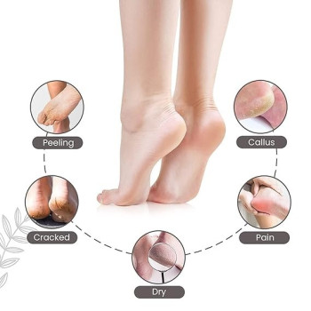 Rechargeable Electric Callus Remover For Foot