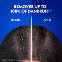 Head And Shoulders Anti Dandruff Menthol Refresh Shampoo, 200 ml