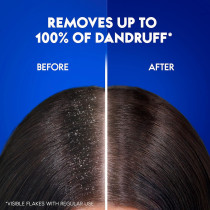 Head And Shoulders Menthol Refresh Anti-Dandruff Shampoo For Itchy Scalp, Pack Of 2, 400 + 200 ml