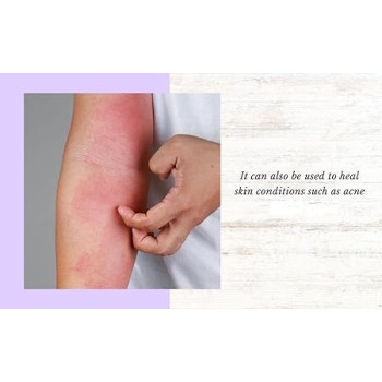 Sudocrem Water-Repellent Base Antiseptic Healing Cream, 60G