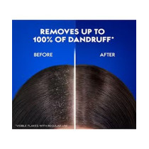 Head And Shoulders Charcoal DetoxAnti-Dandruff Shampoo, 400 ml