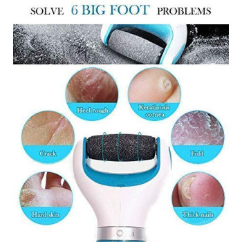 Callus Remover-Electric Foot File, Pedicure Tools For Smoother Heels