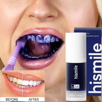 Hismile V34 Toothpaste, Tooth Cleansing, Teeth Whitening Oral Dental Mousse Toothpaste -30ML