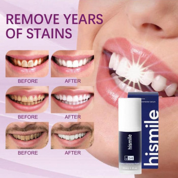 Hismile V34 Toothpaste, Tooth Cleansing, Teeth Whitening Oral Dental Mousse Toothpaste -30ML