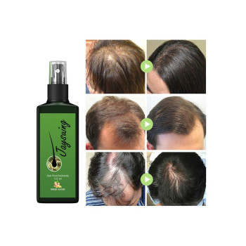 Jaysuing Hair Growth Lotion and Hair Oil For Hair Loss, Repair Damaged Hair, Nourishing Hair Roots & Prevent Baldness - 30 ml