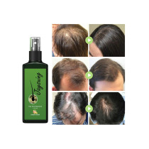 Jaysuing Hair Growth Lotion and Hair Oil For Hair Loss, Repair Damaged Hair, Nourishing Hair Roots & Prevent Baldness - 30 ml