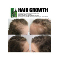 Jaysuing Hair Growth Lotion and Hair Oil For Hair Loss, Repair Damaged Hair, Nourishing Hair Roots & Prevent Baldness - 30 ml