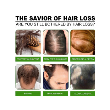 Jaysuing Hair Growth Lotion and Hair Oil For Hair Loss, Repair Damaged Hair, Nourishing Hair Roots & Prevent Baldness - 30 ml