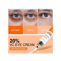 Joypretty Vitamin C Brightening Eye Cream Serum, Remove Dark Circles, Eye Bags, Wrinkles And Fine Lines - 20 ml