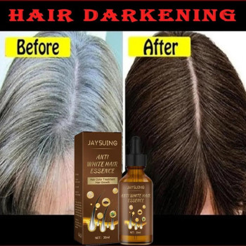 Jaysuing Anti White Hair Serum Gray To Black Nourish Hair Growth Prevents Gray Hair and Promotes Healthy Black Hair - 30ml