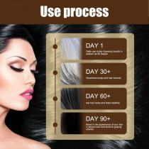 Jaysuing Anti White Hair Serum Gray To Black Nourish Hair Growth Prevents Gray Hair and Promotes Healthy Black Hair - 30ml