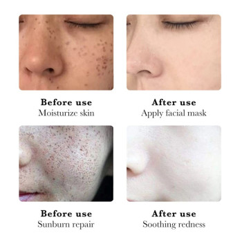 Sadoer Niacinamide Whitening Cream For Anti Aging Spots, Dark Spots, Melasma Freckle Acne Marks, Sunspots By UVA And UVB - 20g