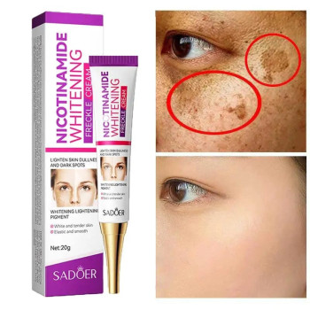 Sadoer Niacinamide Whitening Cream For Anti Aging Spots, Dark Spots, Melasma Freckle Acne Marks, Sunspots By UVA And UVB - 20g