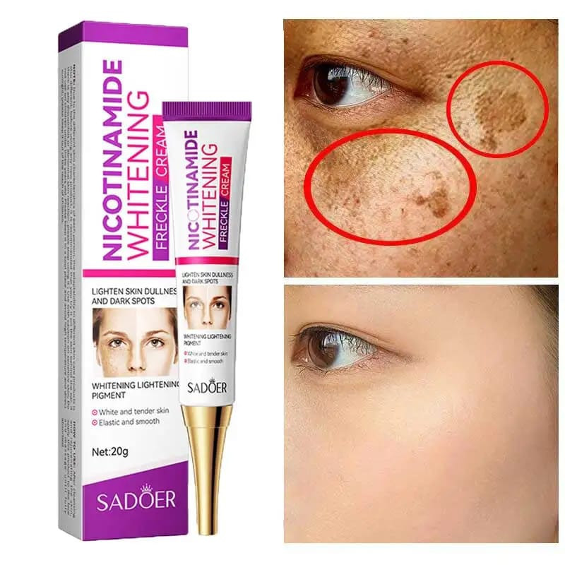 Sadoer Niacinamide Whitening Cream For Anti Aging Spots, Dark Spots, Melasma Freckle Acne Marks, Sunspots By UVA And UVB - 20g