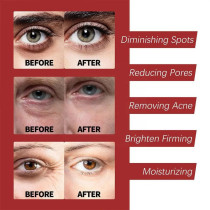 Ouhoe Retinol Collagen Moisturizing Facial Cream With Anti Aging Formula For Firming, Repairing And Nourishing Skin - 30g
