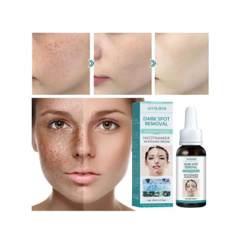 Jaysuing Dark Spot Removal Niacinamide Whitening Serum, Anti-Aging Facial Serum For Age Spots, Acne Marks and Pregnancy Spots - 30 ml