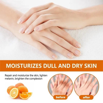 Eelhoe Niacinamide Serum Brighten Dark Knuckles Hands, Knees, Elbows, Armpit Intense Stains Remover Whitening Serum - 30ml