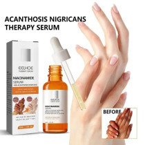 Eelhoe Niacinamide Serum Brighten Dark Knuckles Hands, Knees, Elbows, Armpit Intense Stains Remover Whitening Serum - 30ml