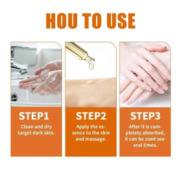 Eelhoe Niacinamide Serum Brighten Dark Knuckles Hands, Knees, Elbows, Armpit Intense Stains Remover Whitening Serum - 30ml