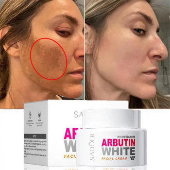 Sadoer Niacinamide Arbutin Moisturizing and Whitening Face Cream For Dark Spots, Anti Aging Spots Sunspots & Freckle Removing - 50g